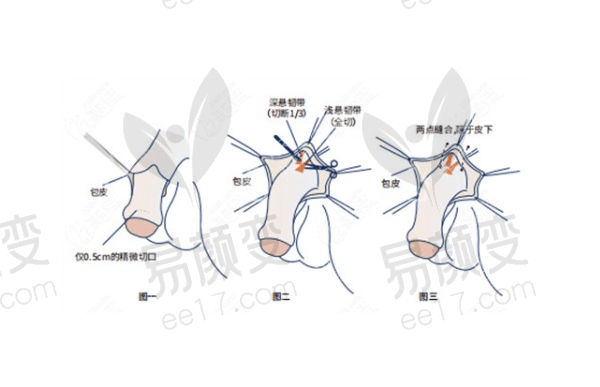 重庆星荣整形外科医院李世荣医生好评实例多