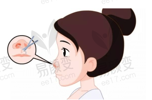 成都新丽美医疗美容医院怎么预约挂号？