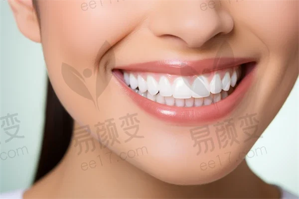 种植牙优惠价仅需9800元起，广州瑞华口腔门诊部为您提供超值选择，原价12000元起，确实值得拥有！